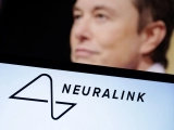 Neuralink apresenta primeiro paciente a inserir um chip no cérebro